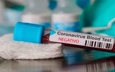 Niño que tenía COVID en Misiones ya tiene su alta médica y no hubo contagio