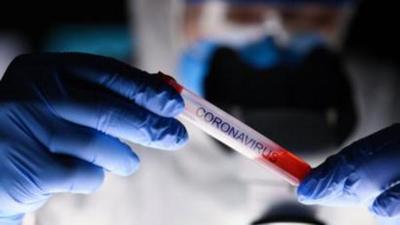 Coronavirus: Latinoamérica supera los 5 millones de casos y se acerca a Europa en muertes