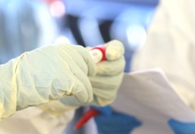 Tres fallecidos y 117 sin nexo, reporta Salud