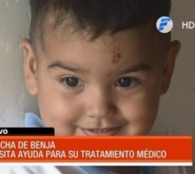 Benjamín de dos años necesita ayuda para costoso tratamiento - Paraguay.com