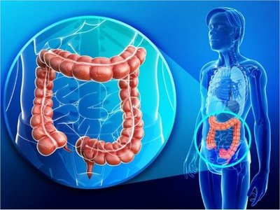 Cáncer de colon aumenta y afecta hasta a adolescentes