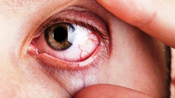 Instan a controles oculares por el “Día Mundial del Glaucoma” - ADN Paraguayo