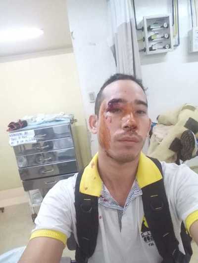 Dos hermanos agreden brutalmente a motociclista en el barrio Santa Ana