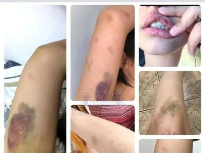 Investigan a cirujano que garroteó a una estudiante que fue su pareja