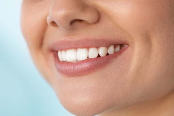 Kit de blanqueamiento dental: Las mejores alternativas del mercado