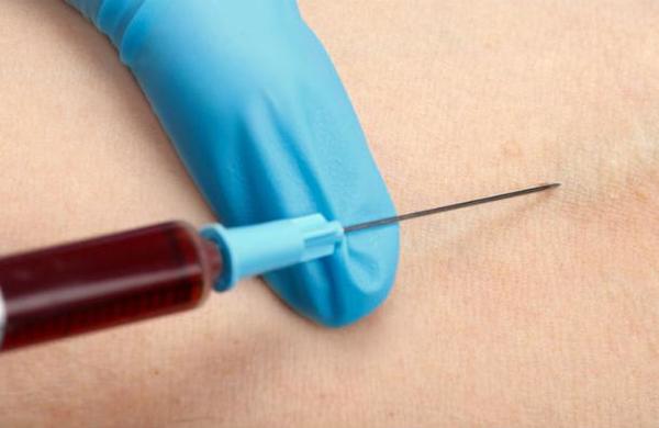 'Era para estar saludable': Mujer casi muere por inyectarse jugo de fruta en la sangre - C9N