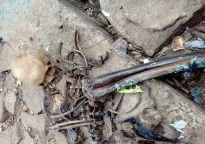 HOY / Hallan cráneo y varios restos óseos en un baldío
