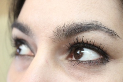 Conjuntivitis: limpieza con agua de manzanilla y otros mitos que son falsos