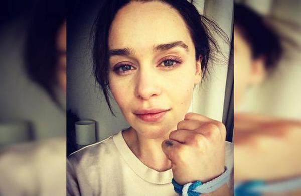'Casi perdí mi mente y mi vida': Emilia Clarke revela que estuvo al borde de la muerte dos veces - C9N