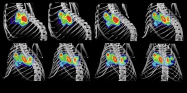 Desarrollan un fármaco que bloquea un gen clave en cáncer - Ciencia - ABC Color
