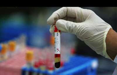 Desmienten audios viralizados en los que se alerta sobre contagio masivo de VIH » Ñanduti