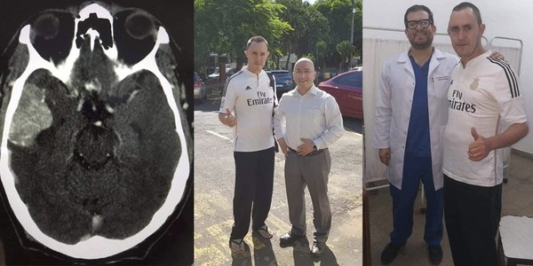 PRIMERA CIRUGÍA DE TUMOR CEREBRAL EN EL HOSPITAL REGIONAL DE ENCARNACIÓN