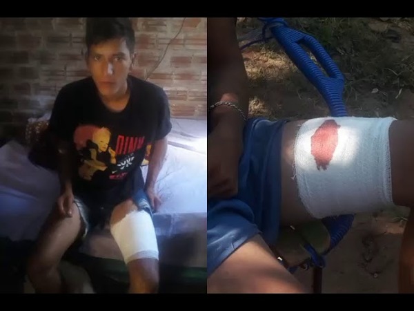 EN CONFUSO EPISODIO JOVEN CON ANTECEDENTES FUE HERIDO POR AJENTE POLICIAL