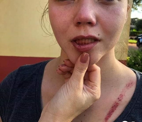 Violencia intrafamiliar en Santa Rita