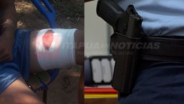 POLICÍA HIRIÓ DE UN DISPARO A DOS HERMANOS EN GENERAL DELGADO.