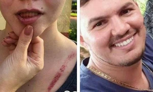 Detienen a violento hombre tras paliza a su expareja