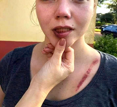 Imputan y piden prisión para hombre que golpeó e intentó matar a su expareja