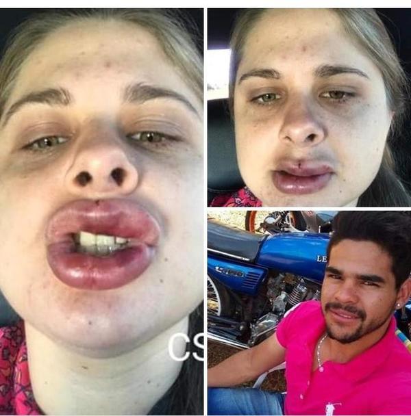 Fiscalía requiere prisión preventiva para golpeador de su ex pareja en Santa Rita
