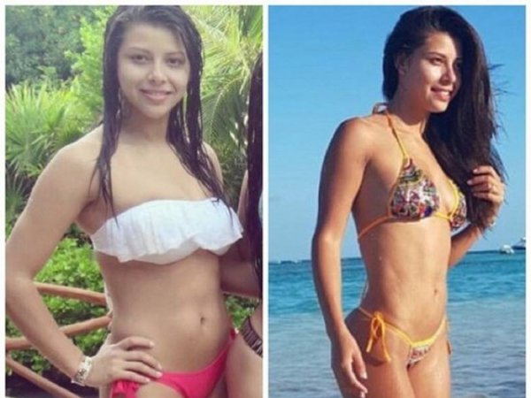 Miss Bombacha Nació de nuevo en el quirófano