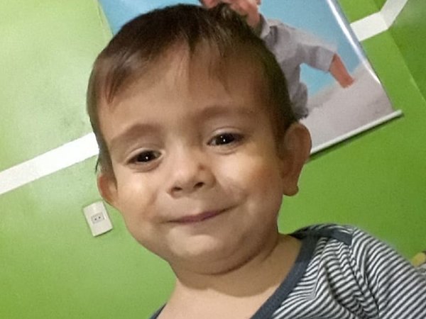 Brunito se sometió a una cirugía, tras una infección
