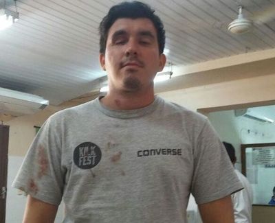 #31M: Joven que perdió un ojo demanda al Estado » Ñanduti