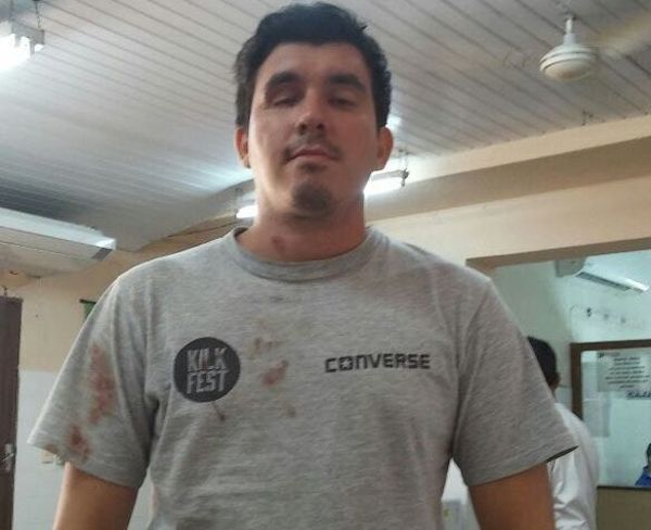 #31M: Joven que perdió un ojo demanda al Estado » Ñanduti
