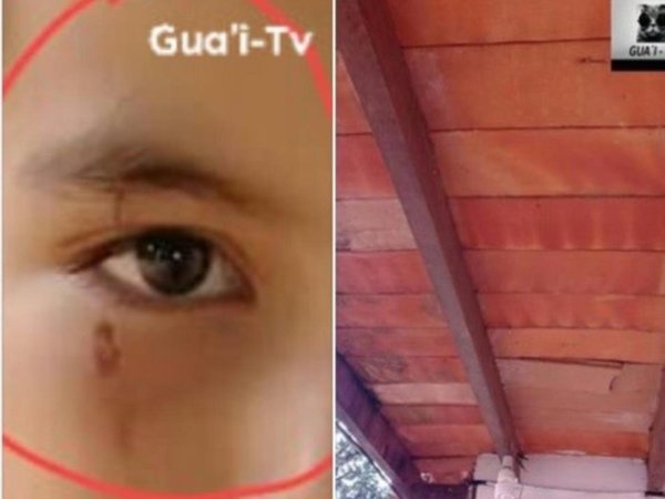 Cayó parte del techo de la escuela y alumno casi perdió el ojo