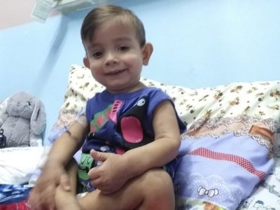Tras cirugía, Brunito bajó de peso