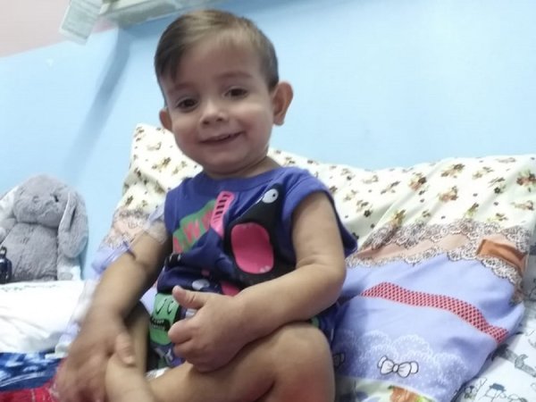 Tras cirugía, Brunito bajó de peso