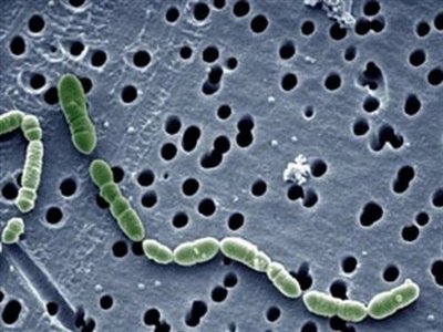 Científicos aislan a una bacteria capaz de sobrevivir en el espacio