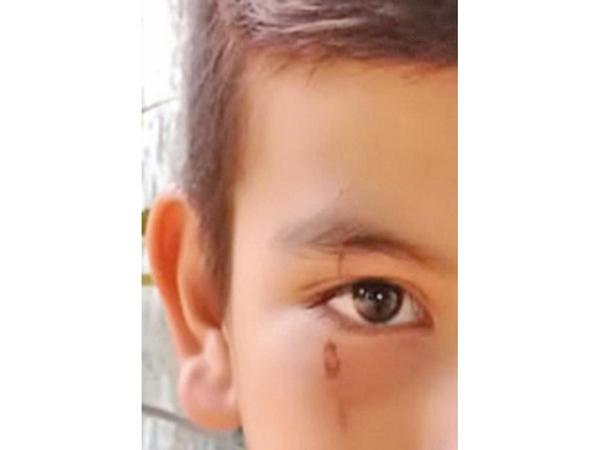 Guairá: Alumno sufre lesión en escuela tras caída de escombros