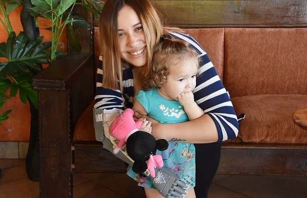 "Es como volver a nacer", asegura madre que utiliza por primera vez prótesis