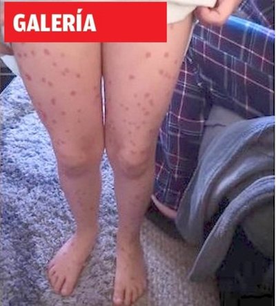Niña “genia” fingió enfermedad para no rendir