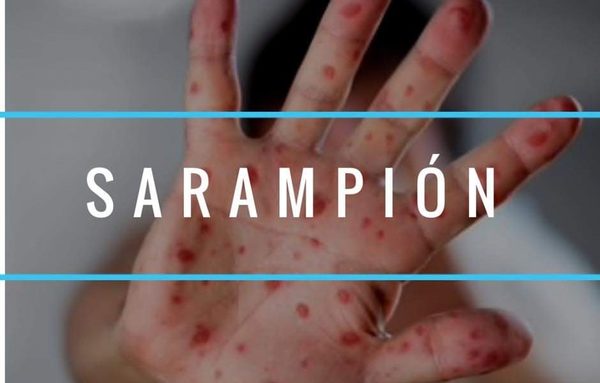 Instan a vacunarse contra sarampión, rubeola y fiebre amarilla