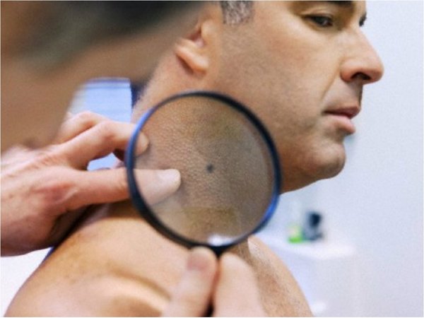 Vacuna experimental contra linfoma muestra resultados prometedores