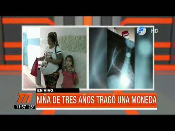 Niña tragó moneda