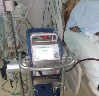 Paciente es conectada con éxito a “Pulmón Artificial” - ADN Paraguayo