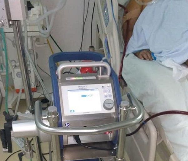 Paciente adulta es conectada con éxito al “pulmón artificial” | Paraguay en Noticias