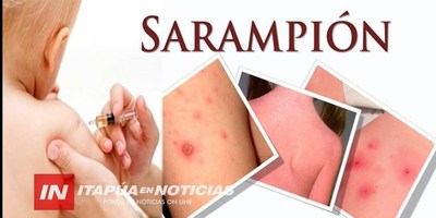 MINISTERIO DE SALUD EN ALERTA ANTE APARICIÓN DE SARAMPIÓN EN MISIONES – ARG.