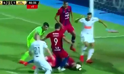 Tenía cuatro costillas rotas, igual intentó trabar con la cabeza para evitar un gol – Prensa 5