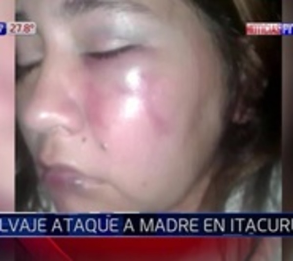 Mujer denuncia salvaje golpiza propinada por su expareja - Paraguay.com
