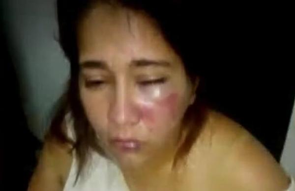 Mujer fue brutalmente golpeada por su expareja en Itacurubí del Rosario - C9N