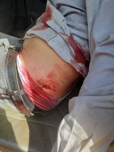 Violentos indígenas balean a tractorista dentro de una propiedad en Itakyry