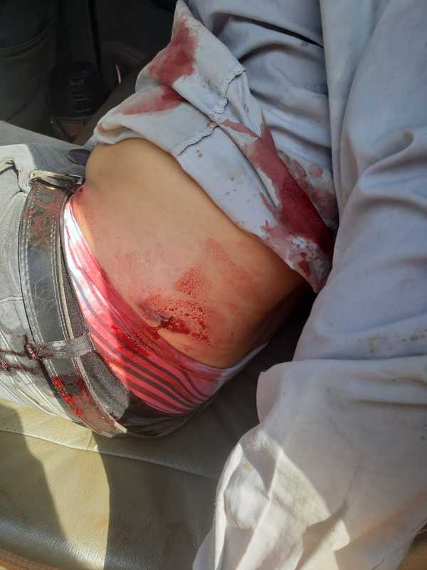 Violentos indígenas balean a tractorista dentro de una propiedad en Itakyry