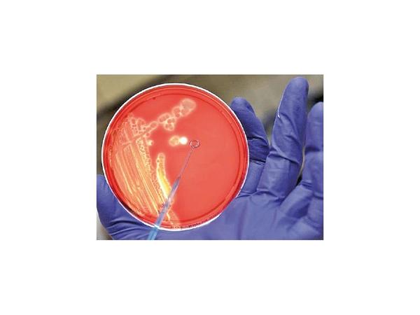 Diseñan una bomba genética capaz de matar solo bacterias