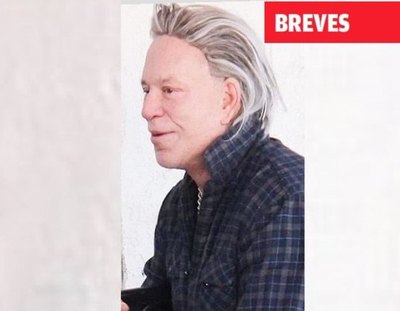 No se le conoce más a causa de las cirugías