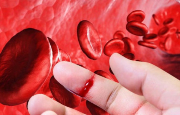 Hemofilia: enfermedad genética que afecta a 1 de cada 10 mil personas - Radio 1000 AM