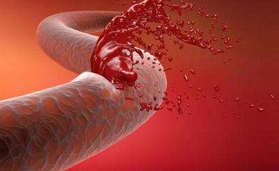 Día de la Hemofilia, que afecta alrededor a 700 paraguayos - ADN Paraguayo