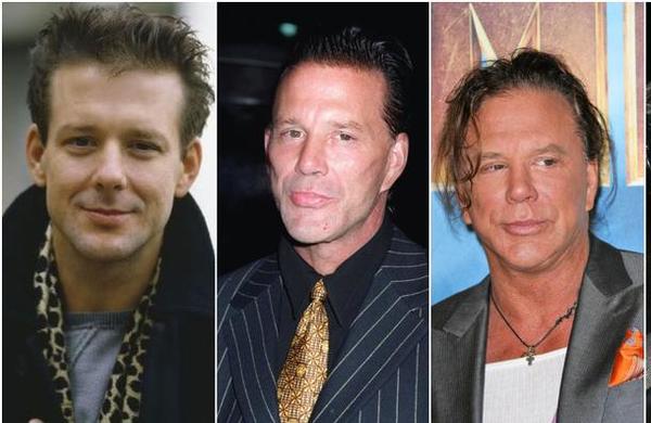 Mickey Rourke vuelve a abusar de la cirugía y ahora luce como un muñeco de goma - C9N