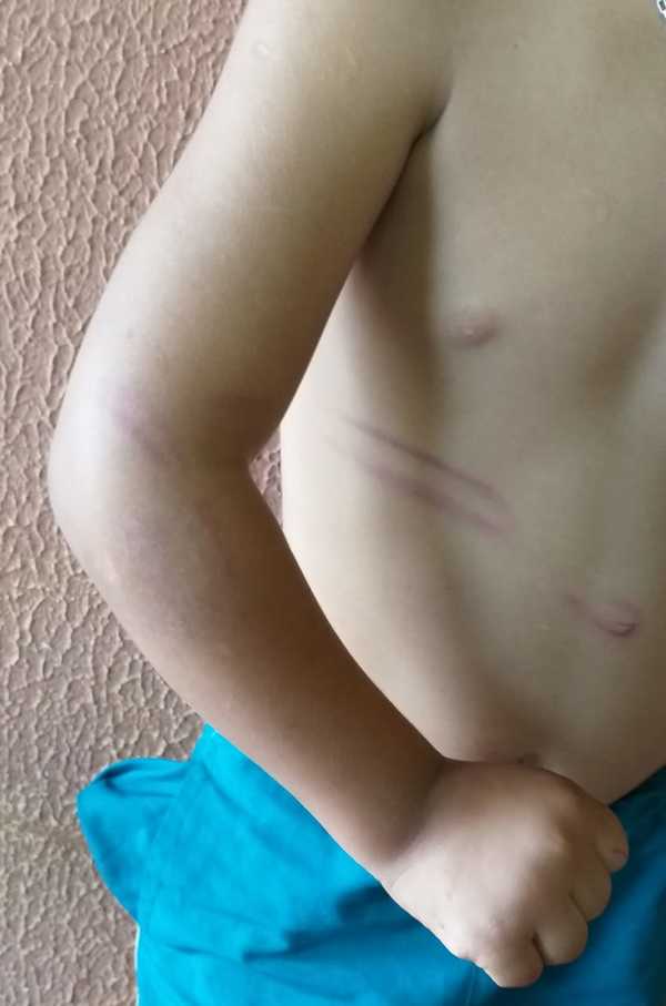 Rescatan a un niño de 4 años que era golpeado con cable por su padre | Diario Vanguardia 09